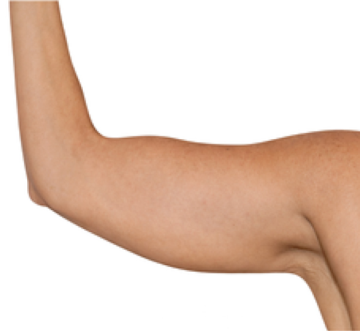 body-treat-1-aft