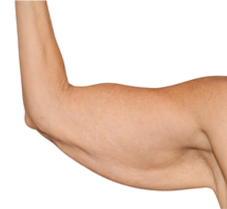 body-treat-1-bfr