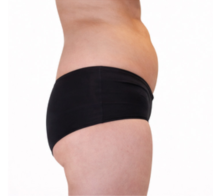 body-treat-11-bfr