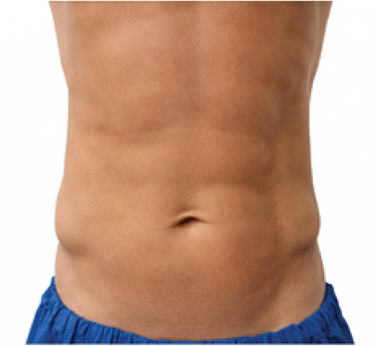 body-treat-2-aft