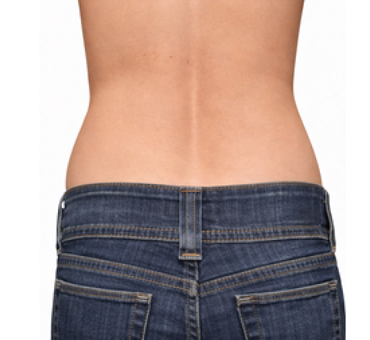 body-treat-5-aft