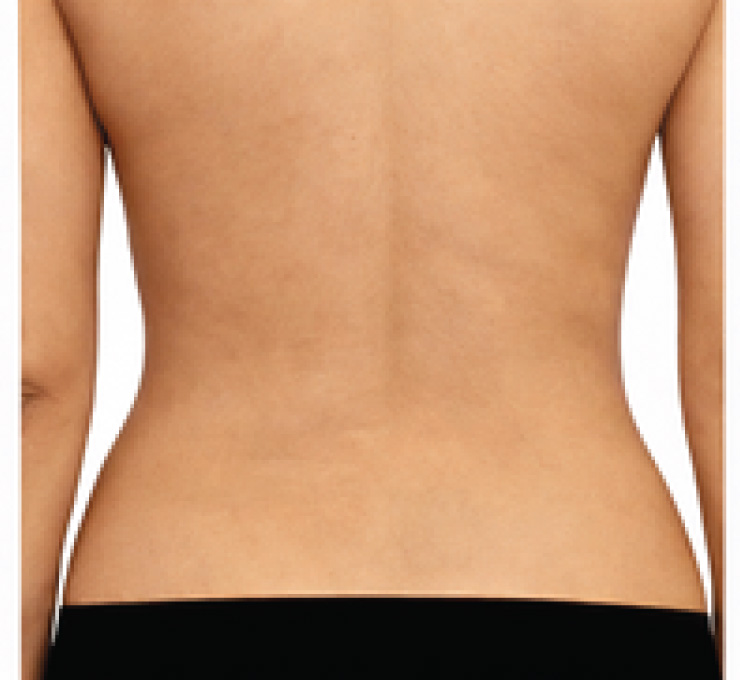 body-treat-6-aft