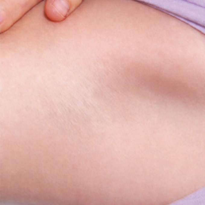 derma-2-aft