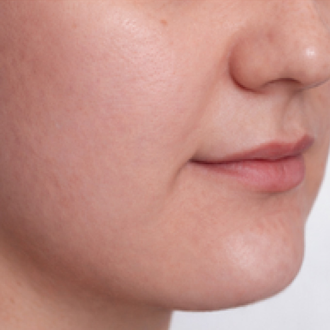 derma-7-aft