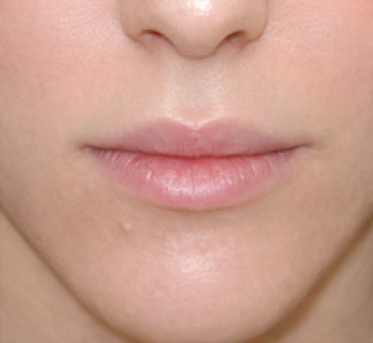 derma-8-aft