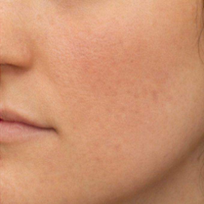 face-mark-1-aft