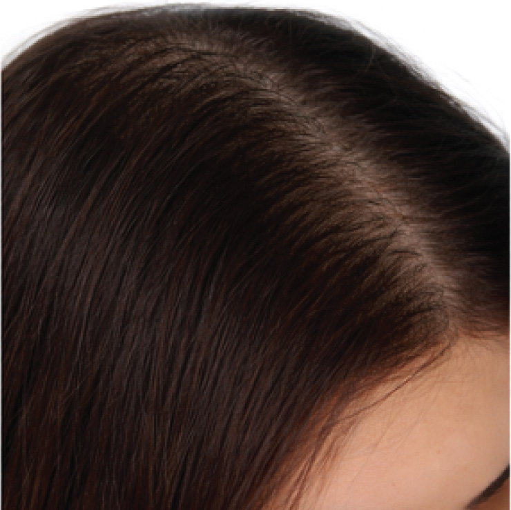 hair-treatment-3-aft